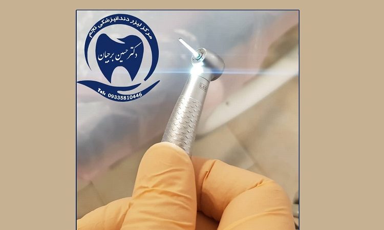 توربین اپتیک تراش دندان با فرزهای الماسه | بهترین دندانپزشک اصفهان