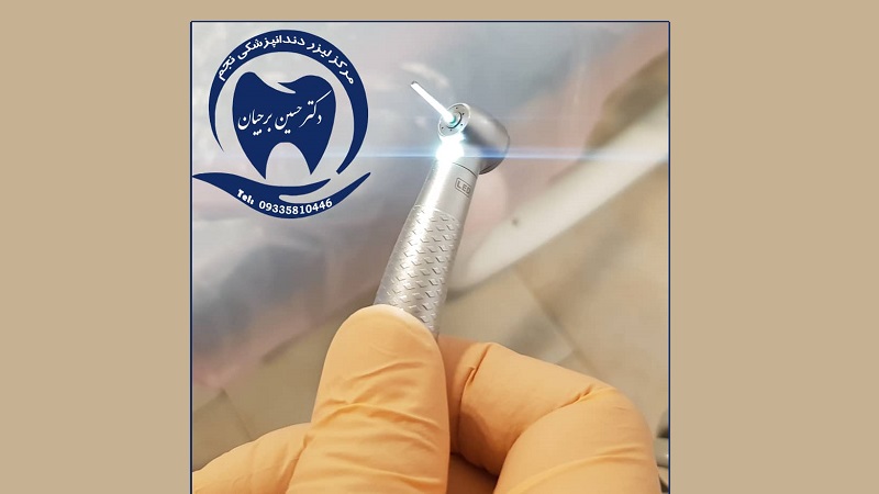 توربین اپتیک تراش دندان با فرزهای الماسه | بهترین دندانپزشک اصفهان