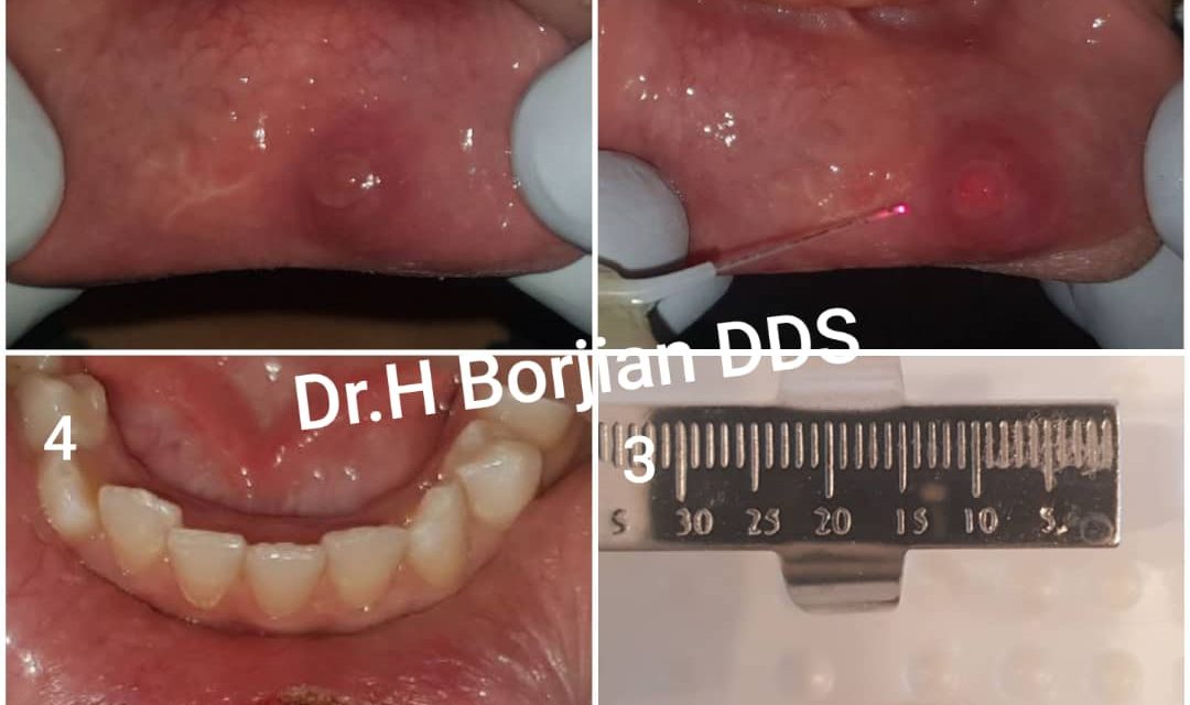 ۸- Traitement des maladies de la bouche, de la mâchoire et du visage par le Dr Hossein Borjian