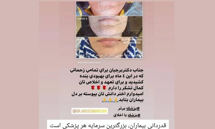 رضایت مراجعه کننده گرامی پس از 4 ماه درمان | افضل زرع في اصفهان