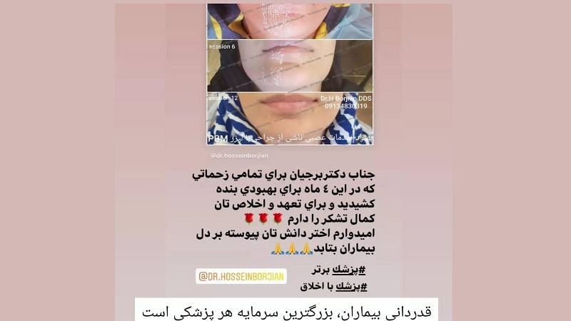 Dear client's satisfaction after 4 The month of treatment | The best implant in Isfahan