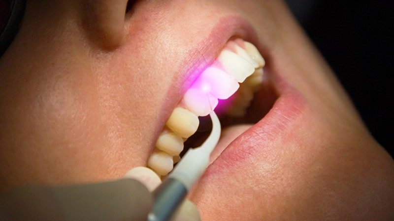 ما هي أنواع جراحات اللثة؟ | افضل دكتور اسنان في اصفهان