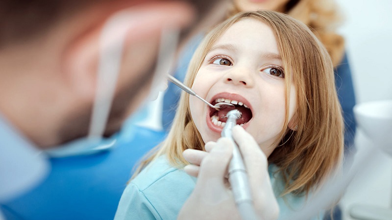Quels sont les types de facettes dentaires ? | Le meilleur dentiste d'Ispahan
