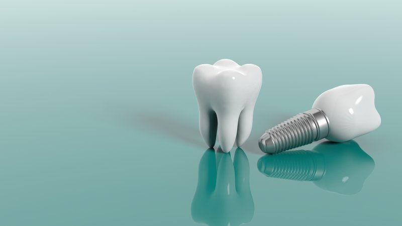 Qu'est-ce qu'un implant dentaire? | Le meilleur implant à Ispahan