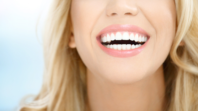 What is the best thickness of dental laminate? | The best cosmetic dentist in Isfahan