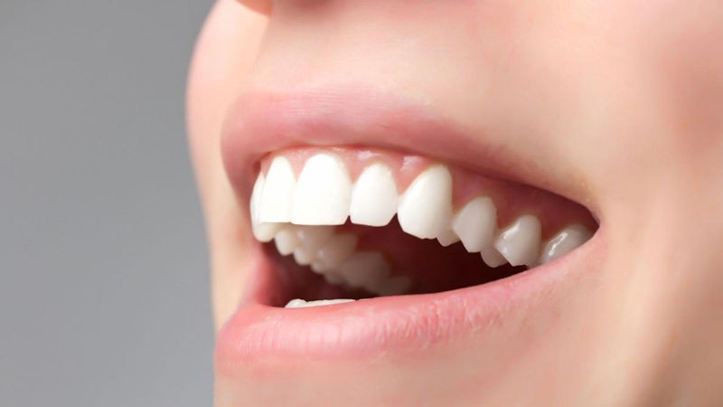 ما هي قشرة الاسنان؟ | افضل دكتور اسنان في اصفهان