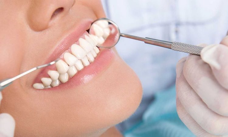 Questions you should know before gum surgery | The best gum surgeon in Isfahan