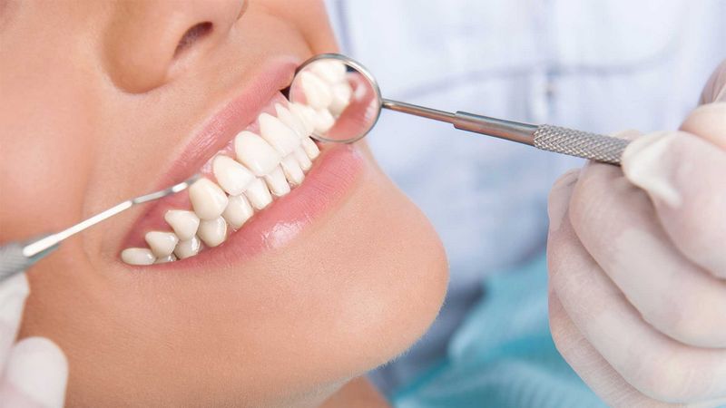 Questions you should know before gum surgery | The best gum surgeon in Isfahan