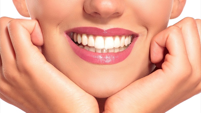 Soins après correction du design du sourire | Le meilleur dentiste cosmétique à Ispahan