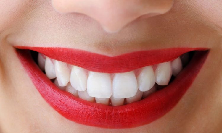 ما هي فوائد تصميم الابتسامة؟ | افضل دكتور اسنان تجميلي في اصفهان