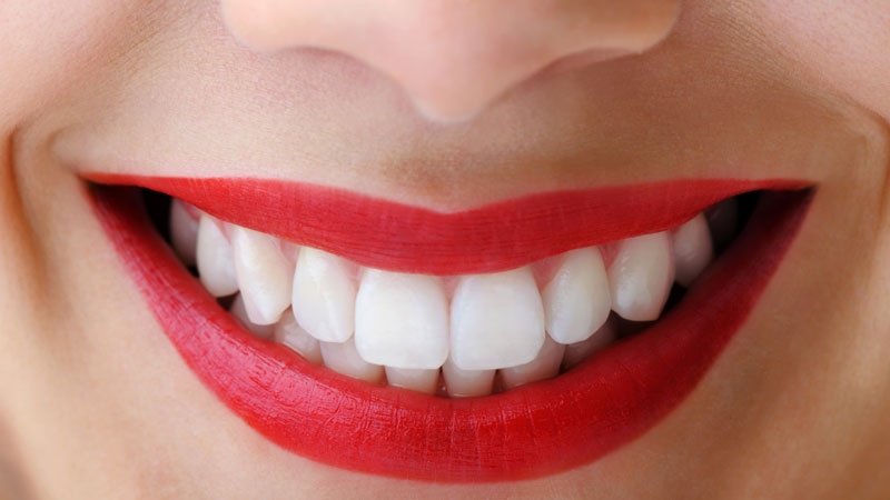 مزایای طراحی لبخند چیست؟ | Le meilleur dentiste cosmétique à Ispahan
