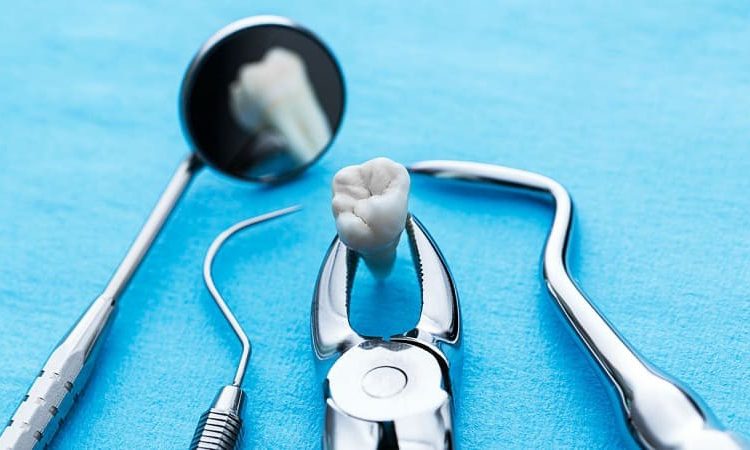 توصیه های لازم پس از کشیدن دندان عقل | Le meilleur dentiste d'Ispahan