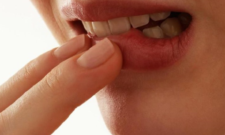 رویکرد کوتاه مدت و درمان فوری آفت دهان | بهترین دندانپزشک اصفهان