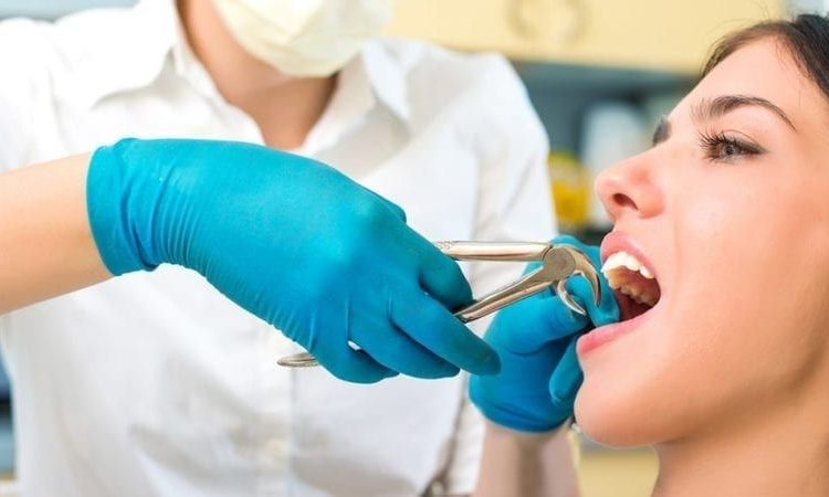 Quel est le bon âge pour extraire les dents de sagesse ? | Le meilleur implant à Ispahan