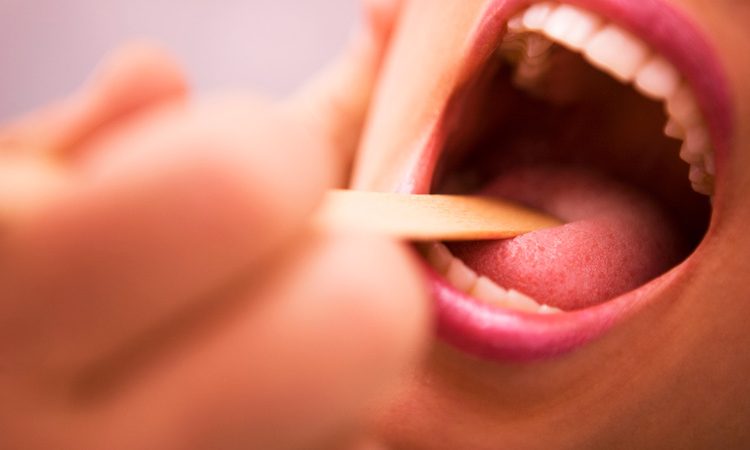 ما هي أسباب وأعراض تكيسات الفم؟ | افضل دكتور اسنان في اصفهان