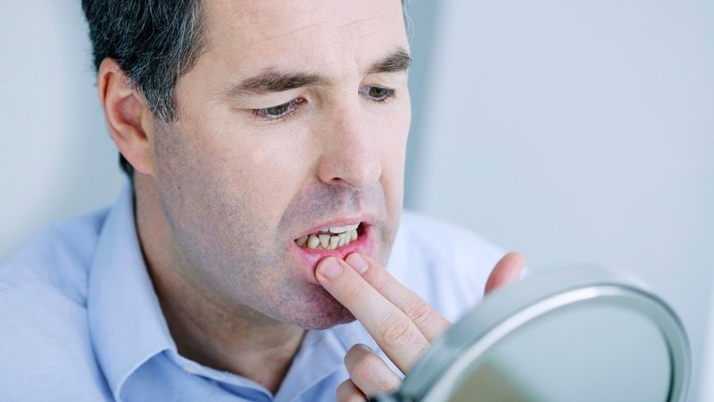 What are the causes and symptoms of oral cysts? | The best dentist in Isfahan