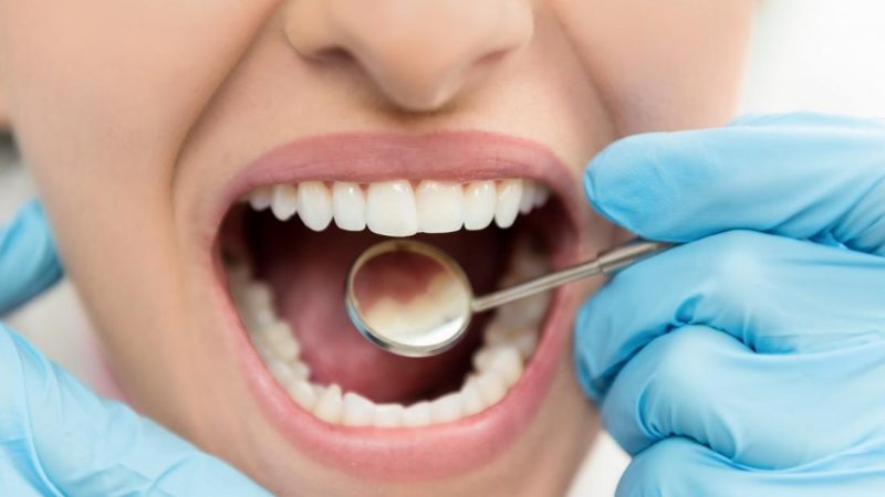What are the causes of gum disease? | The best gum surgeon in Isfahan