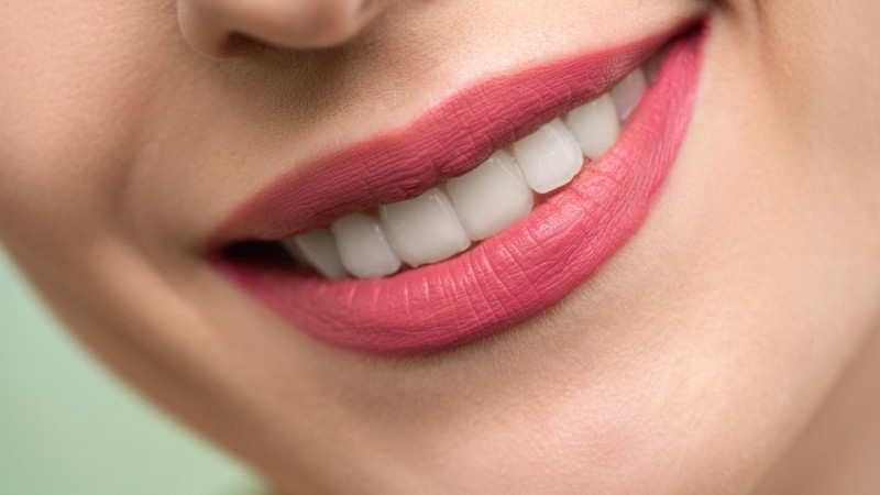 علل تغییر رنگ دندانها بعد از عصب کشی چیست؟ | بهترین دندانپزشک زیبایی اصفهان