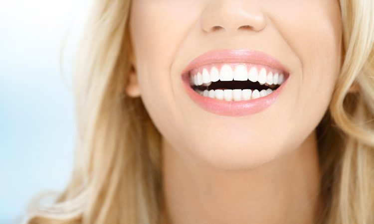 Important tips before laminating teeth | The best implant in Isfahan