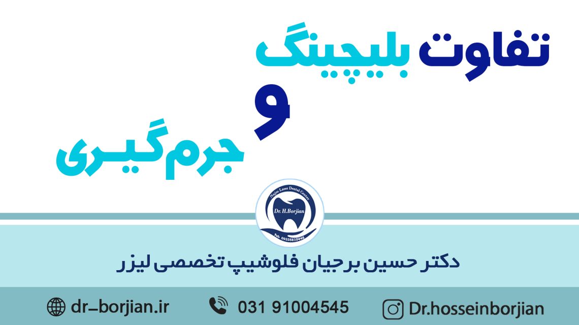 تفاوت بلیچینگ و جرمگیری|بهترین دندانپزشک اصفهان