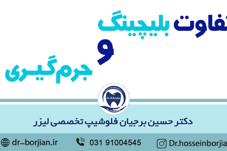تفاوت بلیچینگ و جرمگیری|بهترین دندانپزشک اصفهان