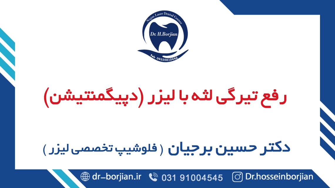 إزالة اللثة الداكنة بالليزر بواسطة أفضل جراح اللثة في أصفهان|افضل دكتور اسنان في اصفهان