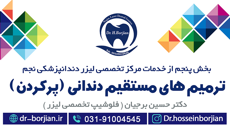 Direct dental restorations | The best dentist in Isfahan