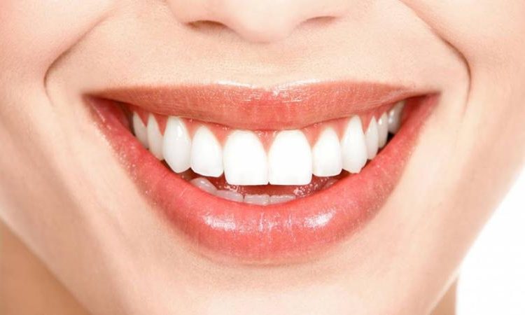 Familiarité avec les étapes de composite dentaire | Le meilleur dentiste d'Ispahan