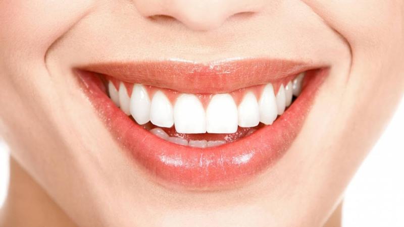 Familiarity with dental composite steps | The best dentist in Isfahan