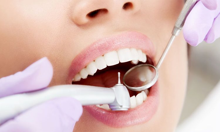 Comparaison de l'obturation dentaire avec l'amalgame et le composite | Le meilleur dentiste d'Ispahan