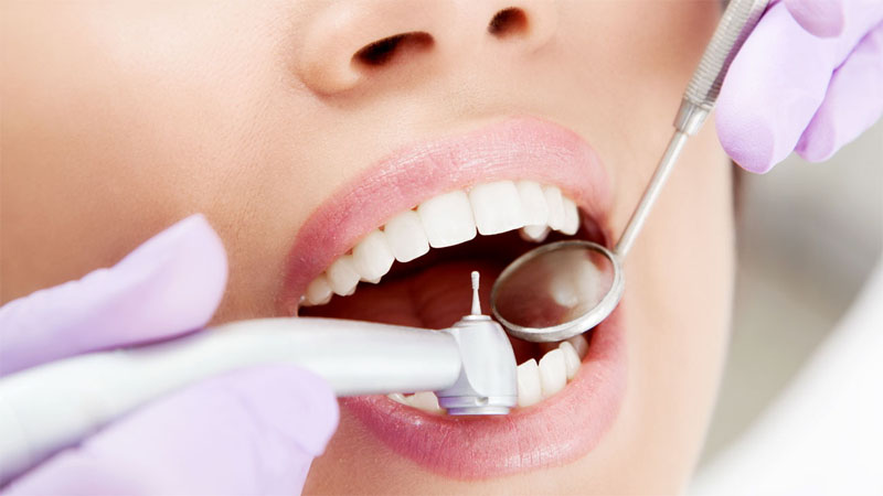 مقایسه پر کردن دندان با آمالگام و کامپوزیت | بهترین دندانپزشک اصفهان