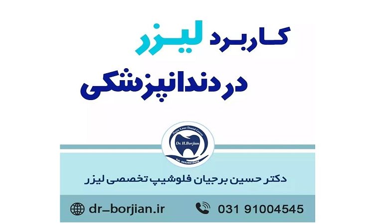 کاربرد لیزر در دندانپزشکی | The best cosmetic dentist in Isfahan