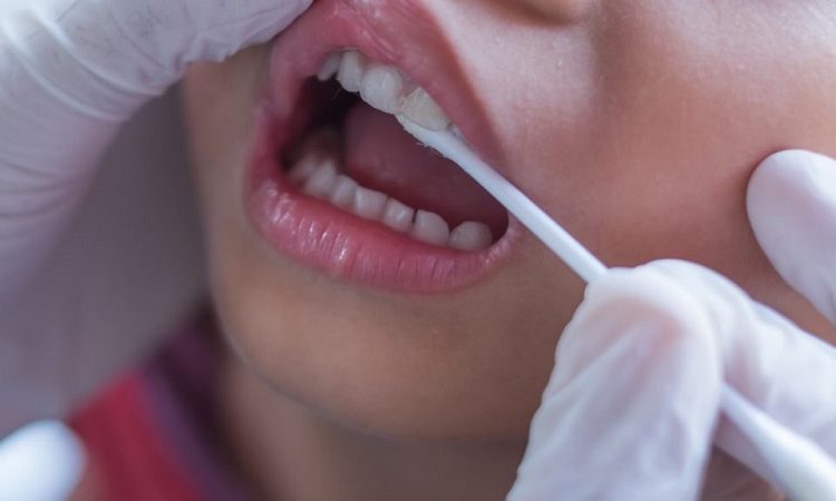 بررسی عوامل و علائم فلوئوروزیس دندانی | بهترین دندانپزشک زیبایی اصفهان