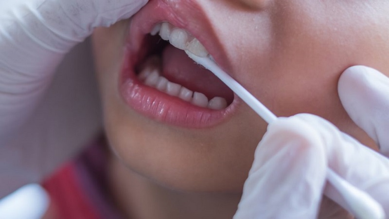 التحقيق في أسباب وأعراض التسمم بالفلور في الأسنان | افضل دكتور اسنان تجميلي في اصفهان