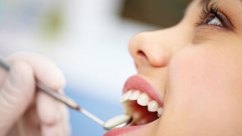 مدت زمان لازم عمل ایمپلنت دندان چقدر است؟ | بهترین جراح لثه اصفهان