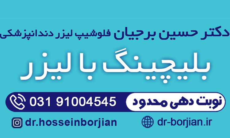 بلیچینگ با لیزر|بهترین دندانپزشک اصفهان