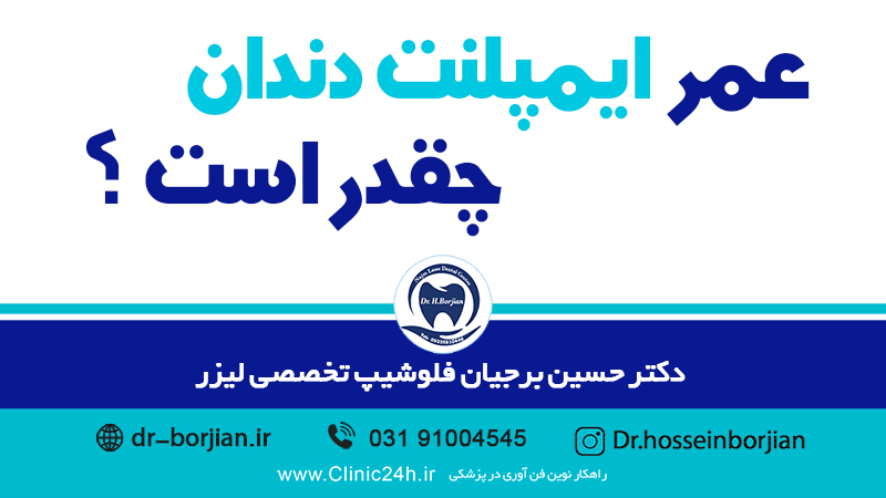 كم تدوم عملية زراعة الأسنان؟|افضل دكتور اسنان في اصفهان