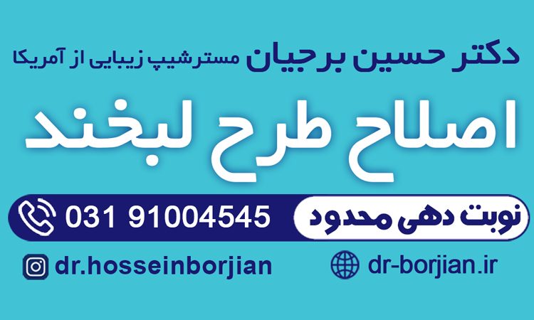 اصلاح طرح لبخند لثه ای|بهترین دندانپزشک اصفهان