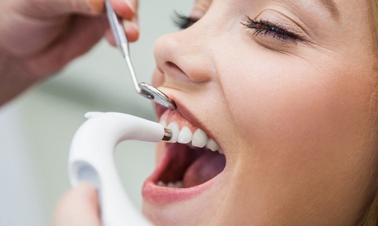 Ce qu’il faut savoir sur le brossage dentaire | Le meilleur chirurgien des gencives à Ispahan