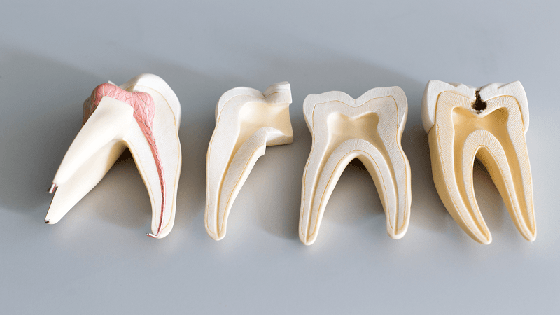 طبقه بندی انواع صدمات به عصب دندان | بهترین دندانپزشک اصفهان