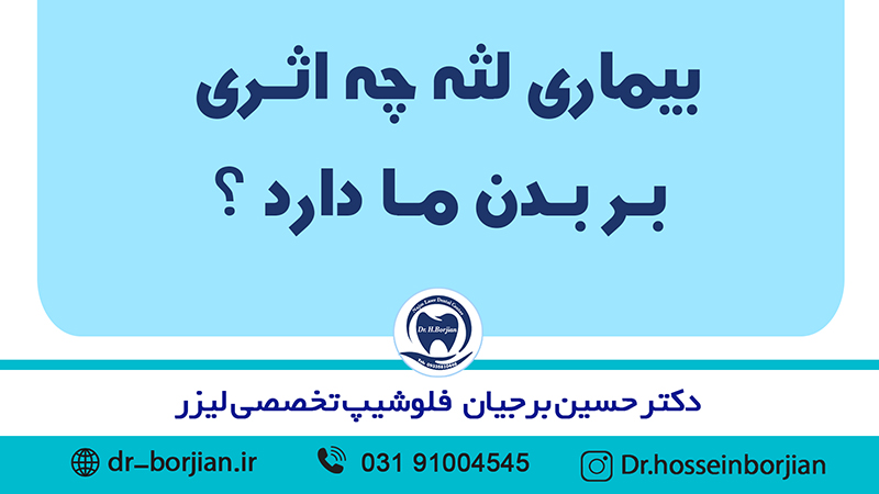 بیماری لثه چه اثری بر بدن ما دارد|افضل دكتور اسنان في اصفهان