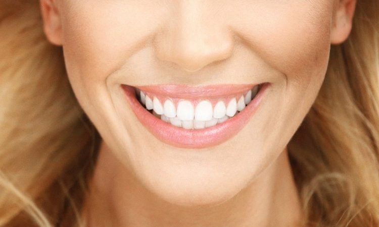 Examiner les différences et les similitudes entre les stratifiés et les composites dentaires | Le meilleur implant à Ispahan