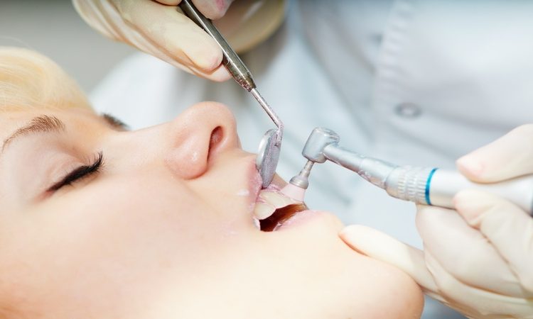 Examen de l'ampleur des dommages dentaires par détartrage | Le meilleur implant à Ispahan