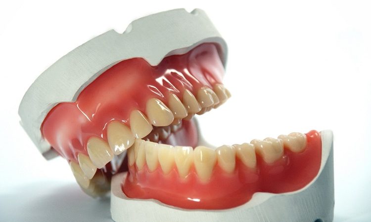 استخدام أنواع مختلفة من الأطراف الصناعية للأسنان | افضل دكتور اسنان في اصفهان