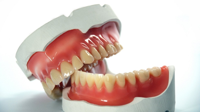 L'utilisation de différents types de prothèses dentaires | Le meilleur dentiste d'Ispahan