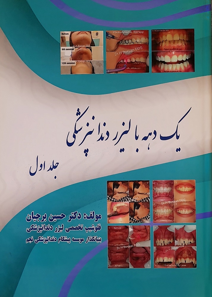 كتاب عقد مع صورة غلاف لطب الأسنان بالليزر