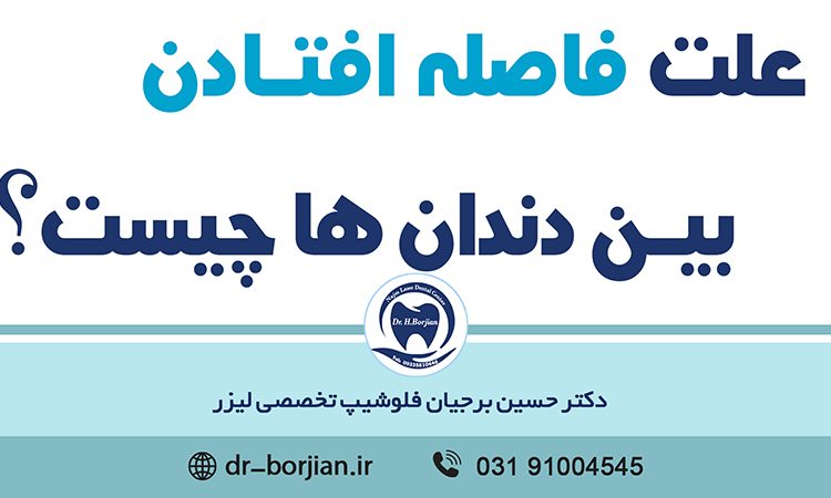 علت فاصله افتادن بین دندان ها|بهترین دندانپزشک اصفهان