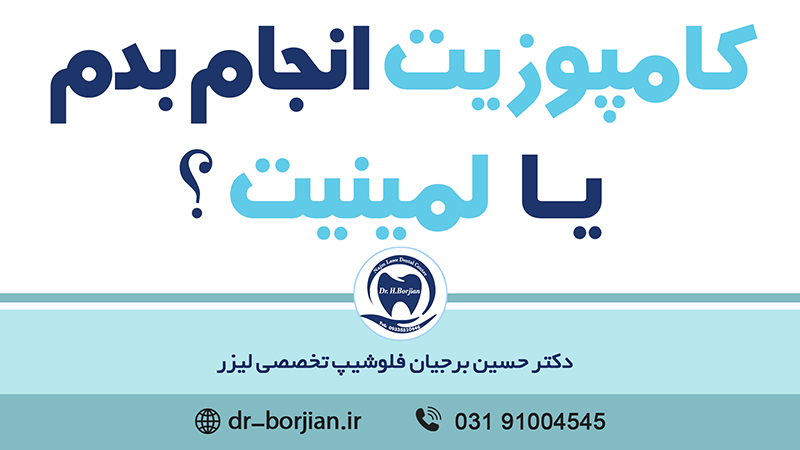 کامپوزیت یا لمینیت|افضل دكتور اسنان في اصفهان