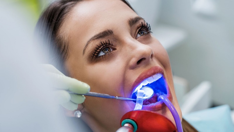 درمان ایمپلنت با استفاده از لیزر | بهترین دندانپزشک اصفهان