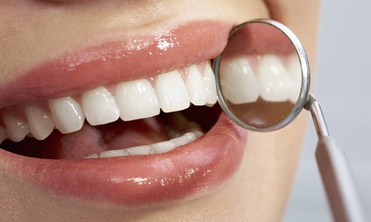 Moyens de prévenir les facteurs de rupture des composites dentaires | Le meilleur dentiste cosmétique à Ispahan